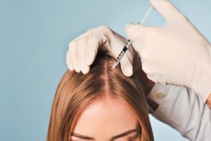 prp hair restoration