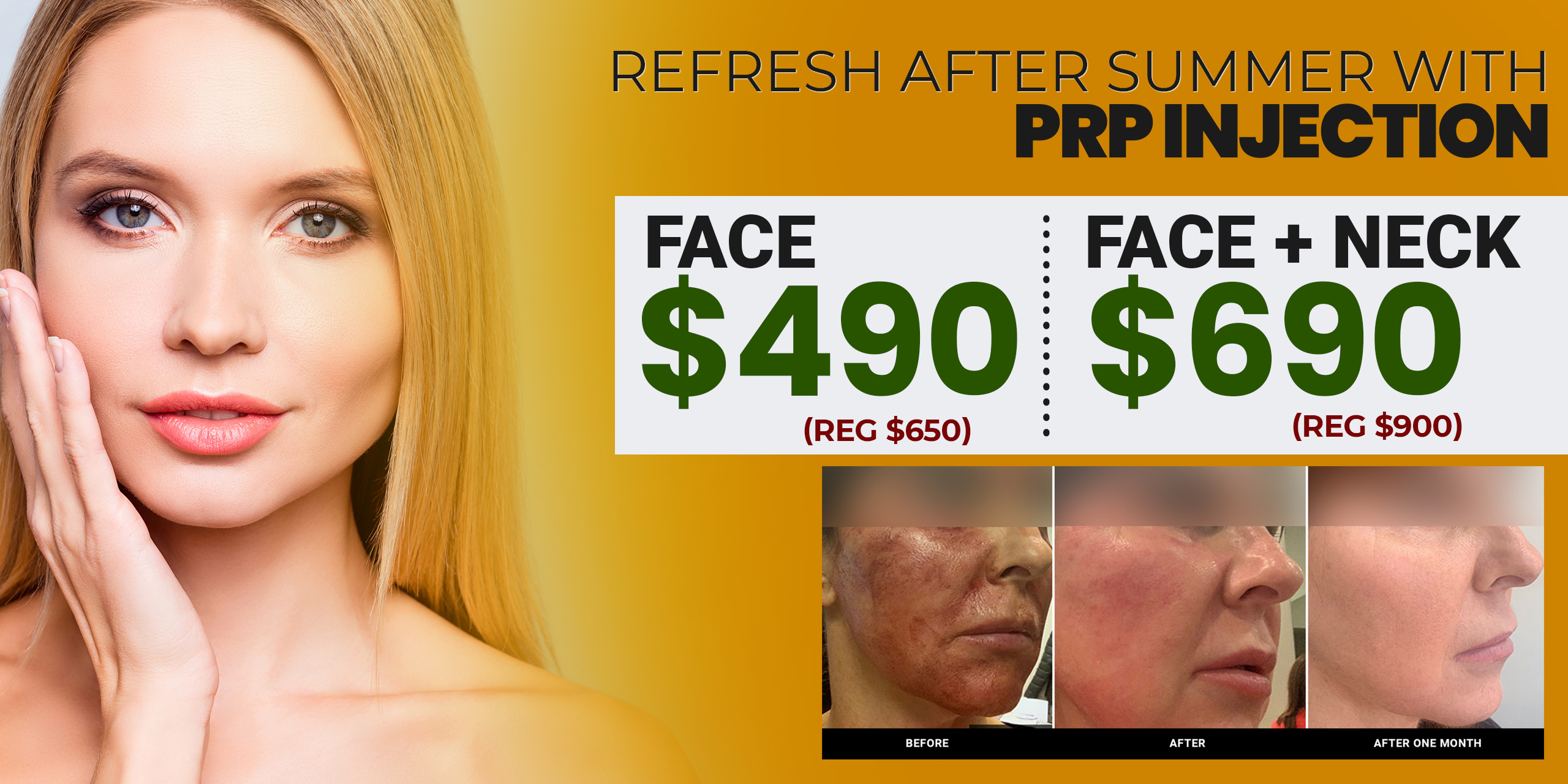 Cosmetic Services New You Chicago